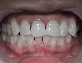 after image