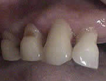 after image1