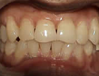 Before Image