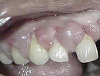 before image1